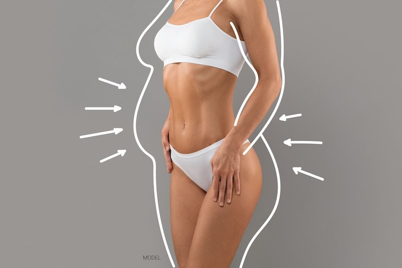 Was ist ein Mommy Makeover?