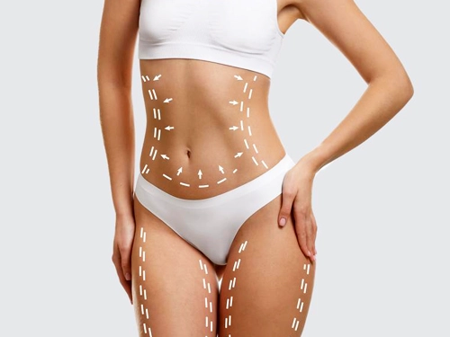 Ist ein Mommy Makeover gefährlich