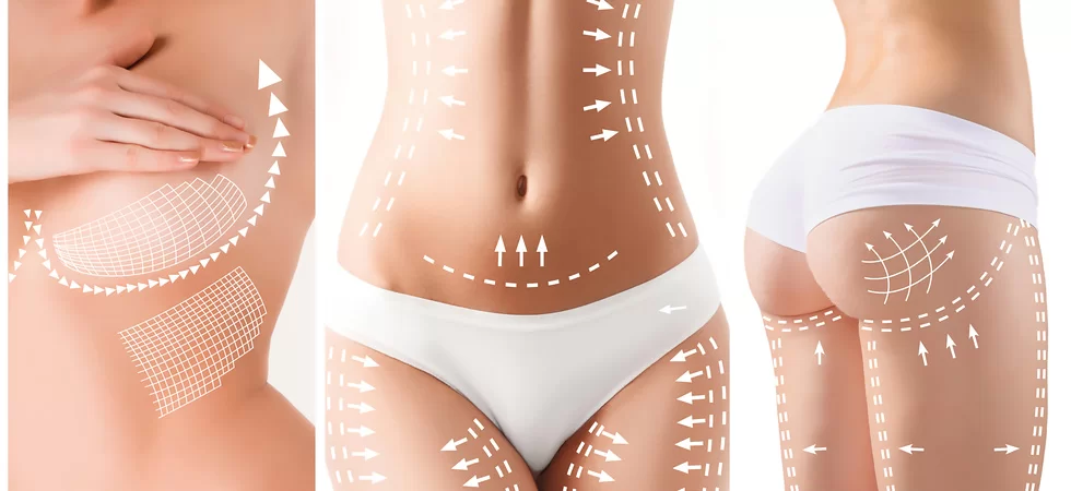 Was ist ein Mommy Makeover?